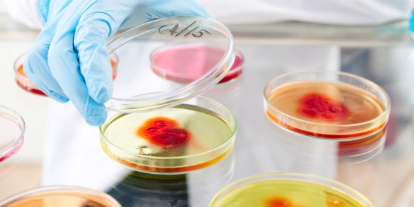 Bakterie E.coli w wodzie - co warto wiedzieć? Jak usuwać?