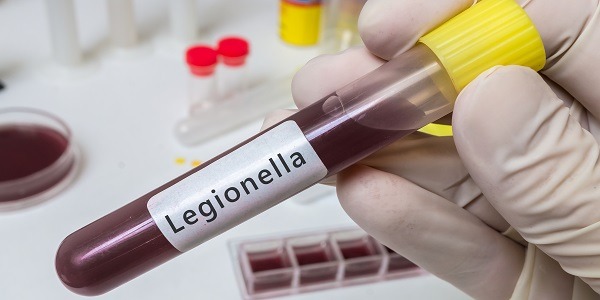 Bakteria Legionella w wodzie. Jak ją usuwać?