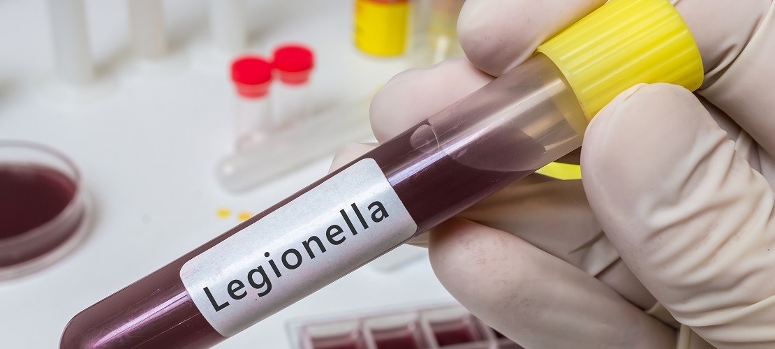 Bakteria Legionella w wodzie. Jak ją usuwać?
